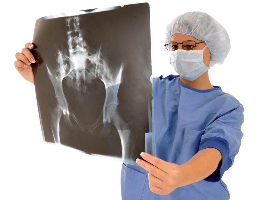 Puusaliigese röntgenuuring aitab arstil kindlaks teha valu põhjuse