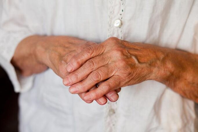 Valu käte liigestes häirib sageli vanemaid inimesi