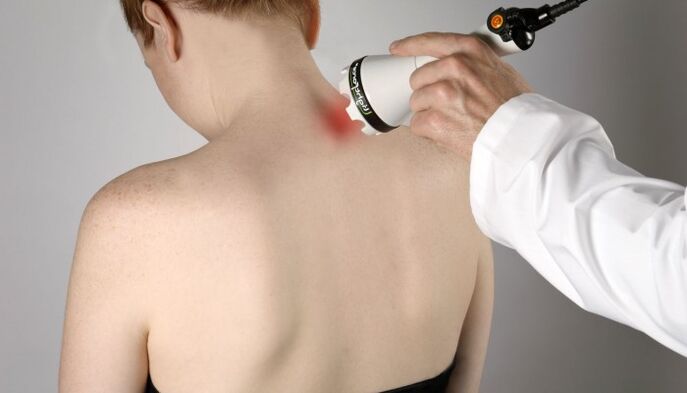 Emakakaela osteokondroosi laserteraapia